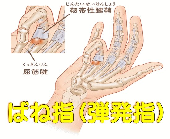 バネ指の整体 八戸市白銀町 弾発指は関節の調整と靭帯のほぐし
